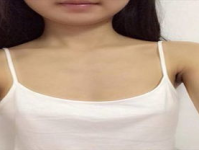 天生胸小怎么丰胸,“揭秘天生胸小如何实现丰满美胸”